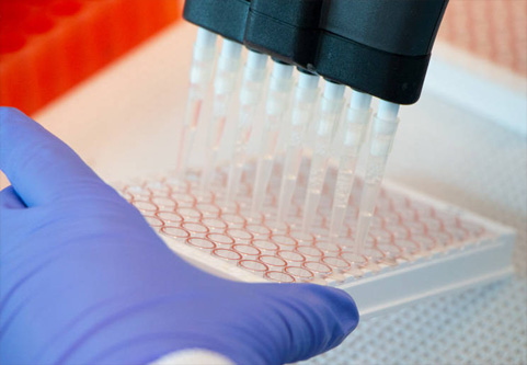 TCR Lentivirus Packaging Kit