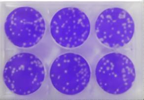 A schematic description of the plaque formation assay. (Toister, et al., 2024)