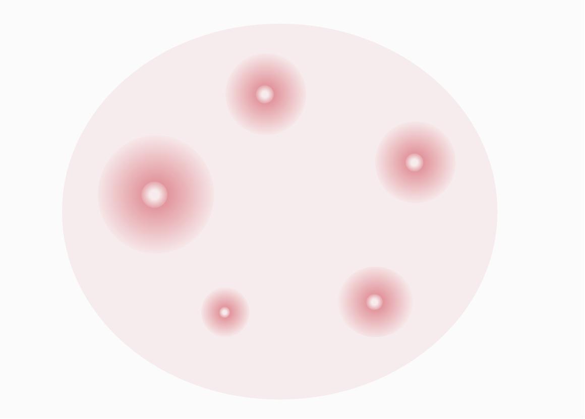 Single tibial hemolysis. (Creative Biolabs original)