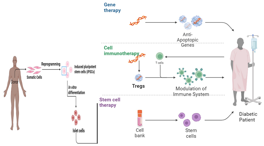 The role of gene therapy, cell immunotherapy, and stem cell therapy in diabetes mellitus
