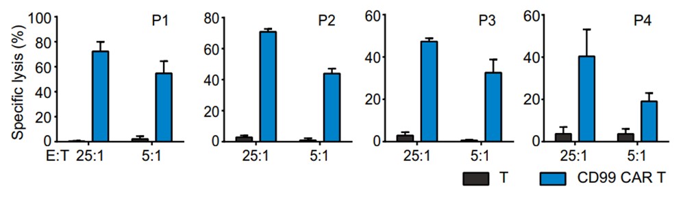 Fig.4 Cytotoxic assessment of the CD99 CAR-T cells against target cells from T-ALL patients' blasts at indicated E:T ratios. (Shi, Jiangzhou, et al., 2021)