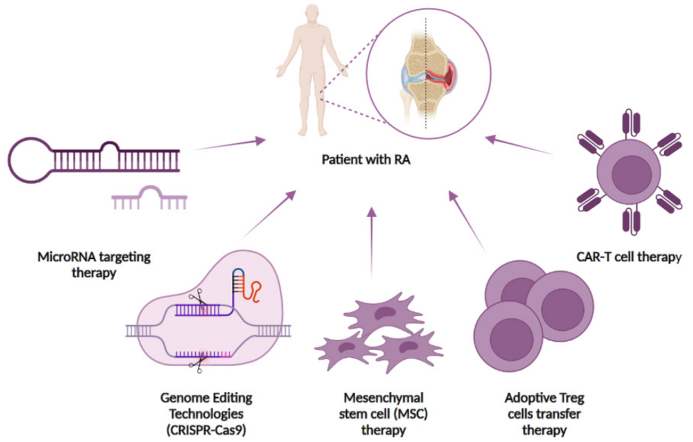 Cell-based and genome-editing therapies for rheumatoid arthritis (RA) treatment.