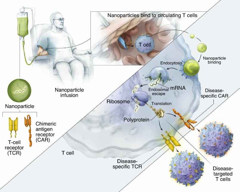 Fig.2 IVT mRNA transported by polymeric nanoparticles programming T cells in situ.