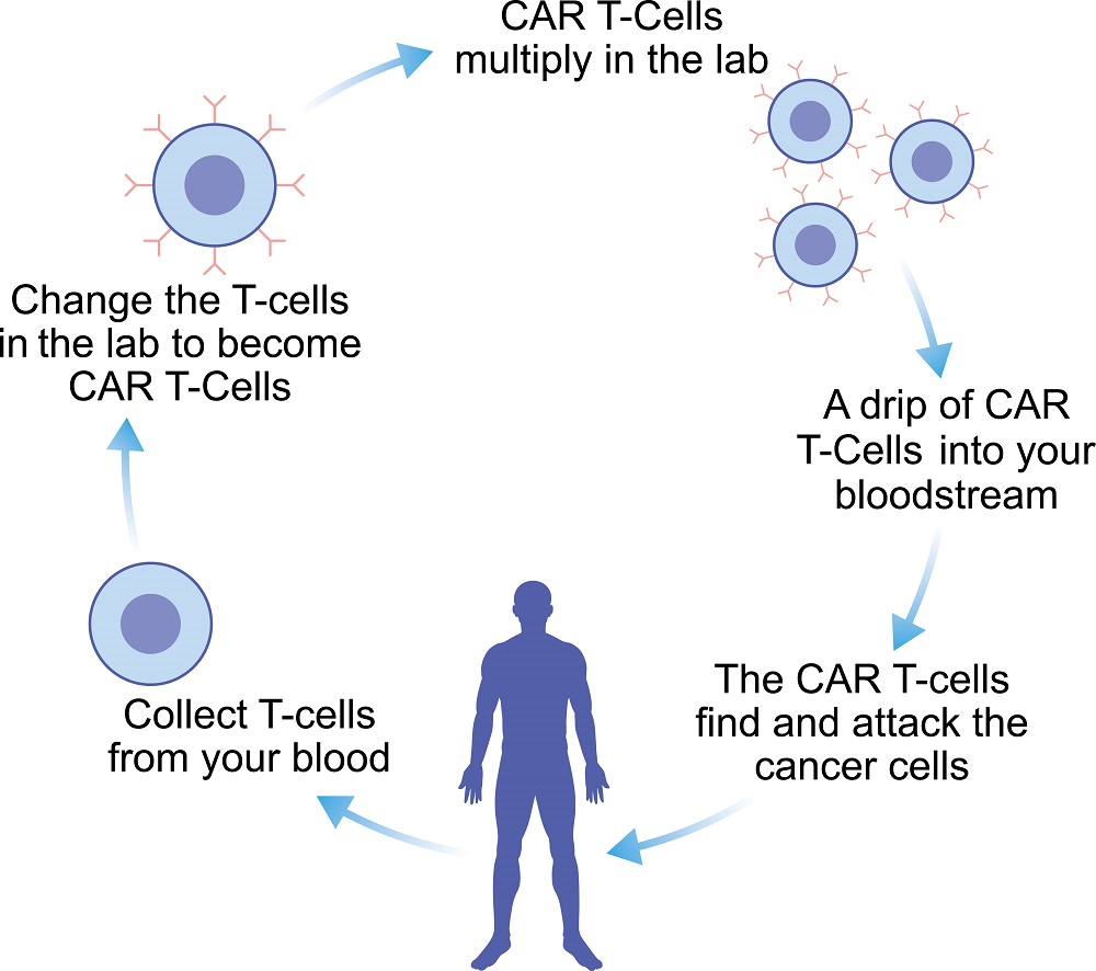Figure 1 Processes of CAR T-cell therapy (Creative Biolabs Authorized)
