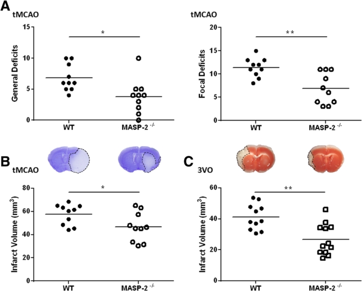 MASP-2 deficiency is protective following cerebral IRI.
