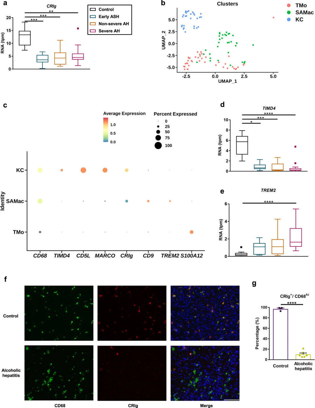 Patients with alcohol-related liver disease have less CRIg expression on liver macrophages.