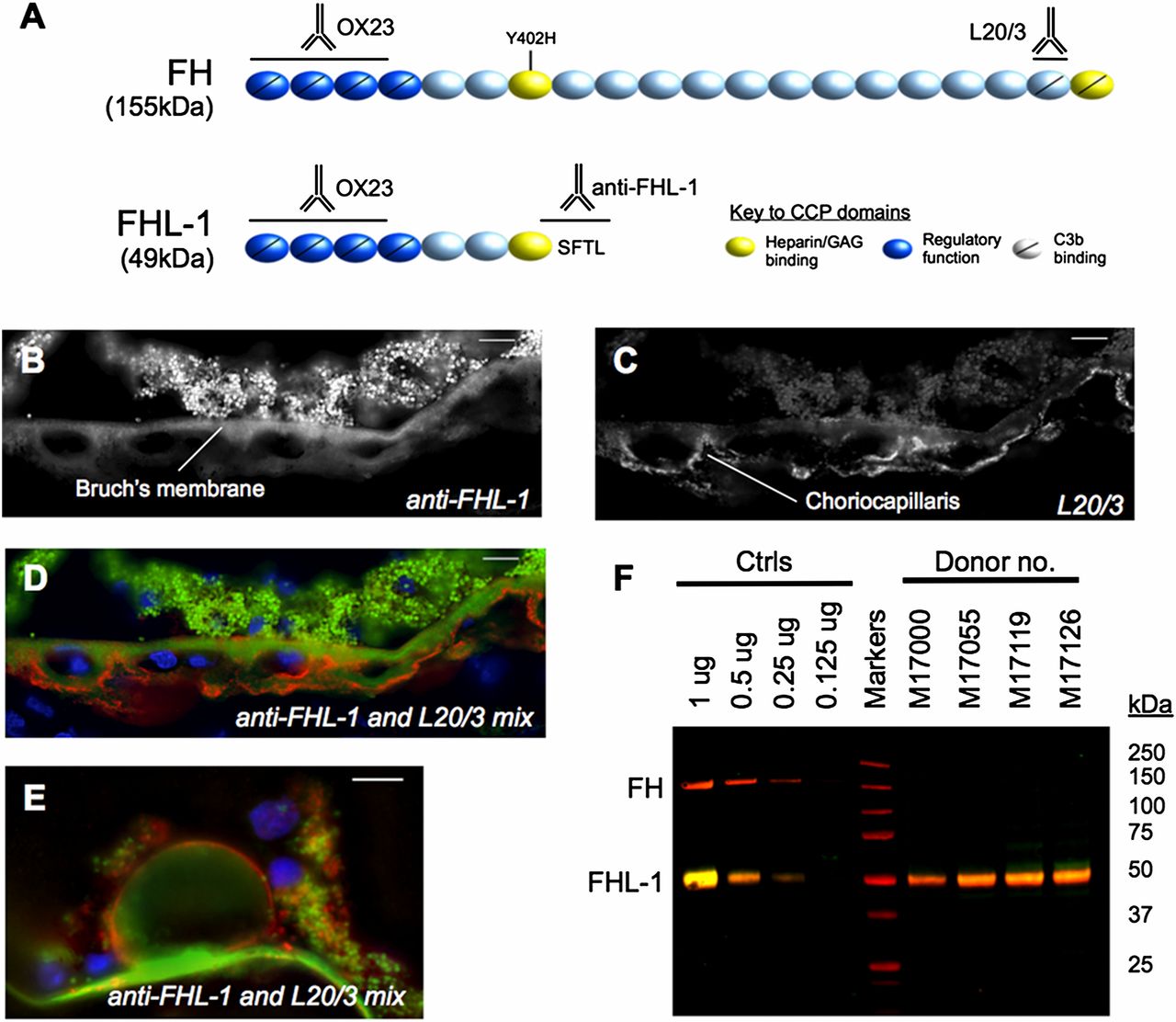 The regulatory role of complement regulator factor H-like protein 1 (FHL-1) in human Bruch's membrane.