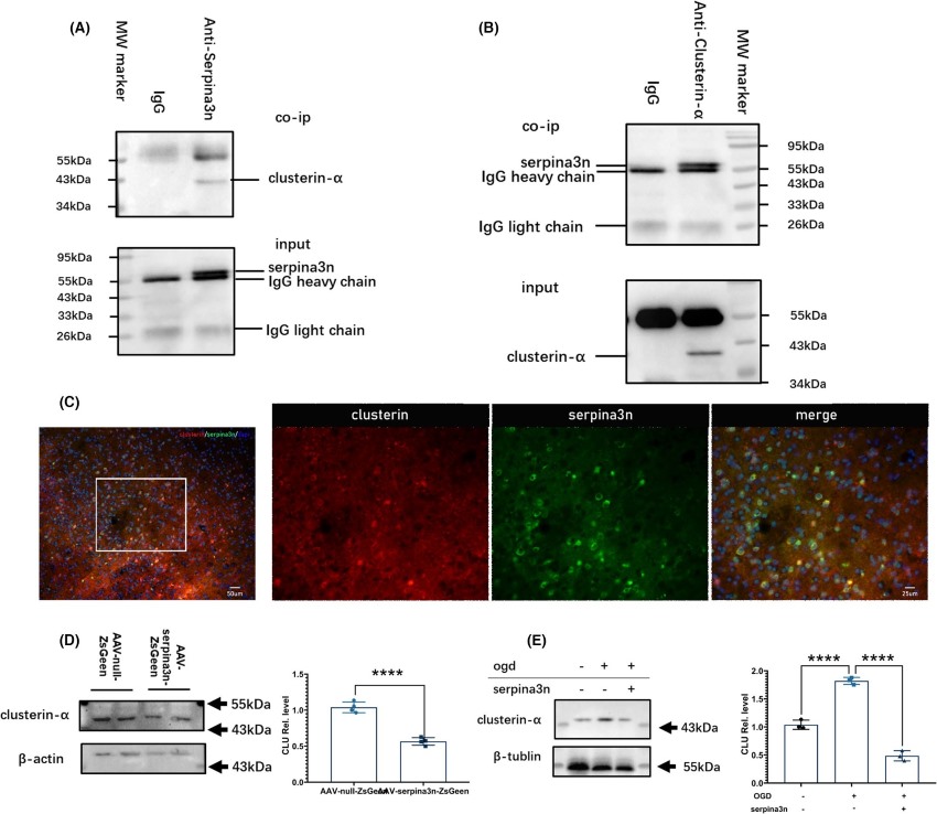 Identification of clusterin as a SerpinA3N-interacting protein.