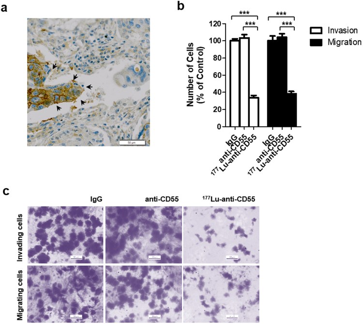 Fig 2. Schematic of effects of the 177Lu-anti-CD55 antibody on invasion and migration in lung cancer cells. (OA Literature)