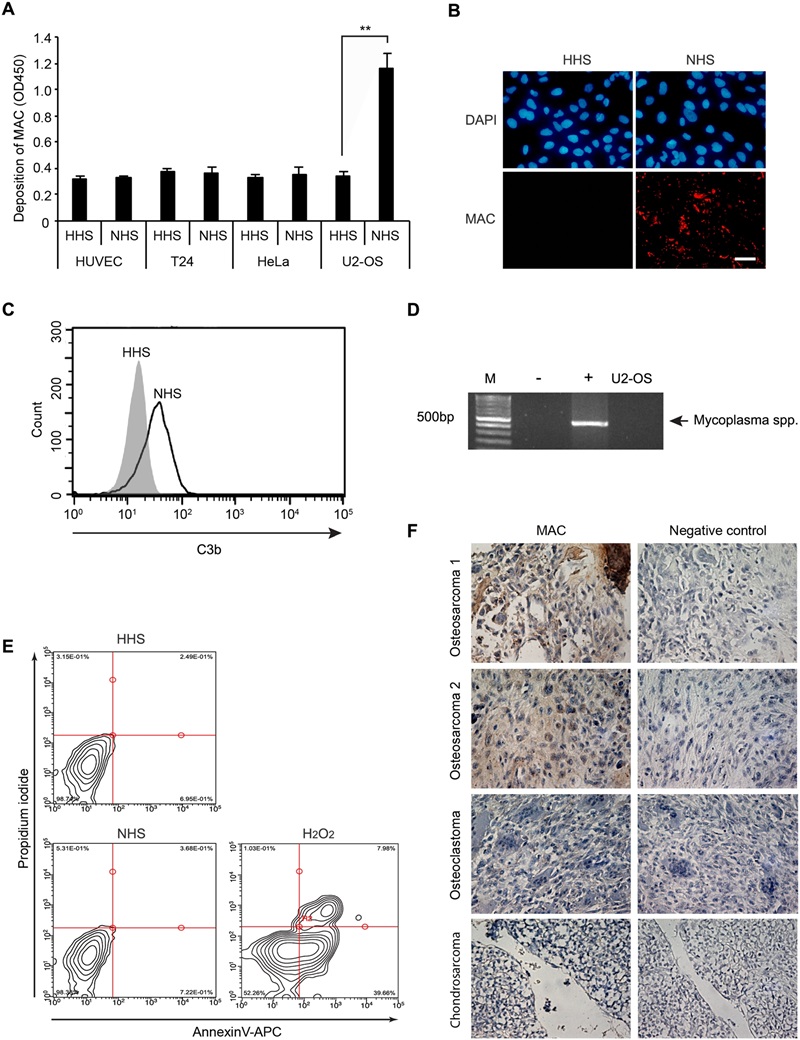 Activation of the complement system in an osteosarcoma cell line.