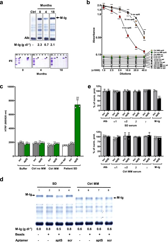 Fig. 3 Specificity of aptamer in patient serum.