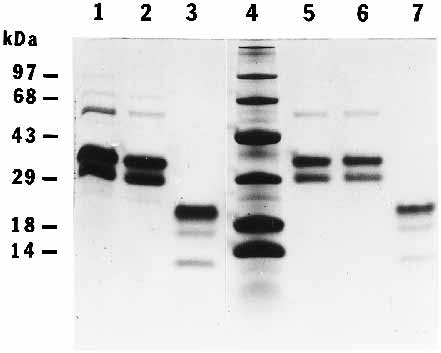 Trypsin cleaves all three chains of C1q-CLR.