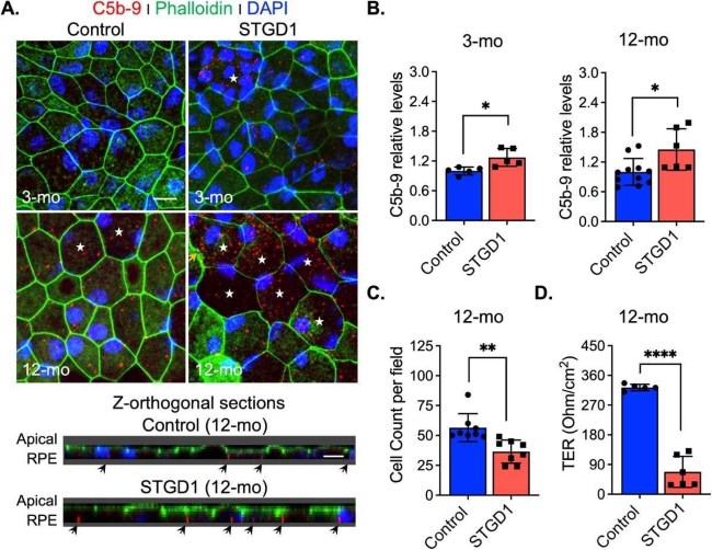 MAC (C5b-9) deposition induces cell damage in STGD1 RPE cells.