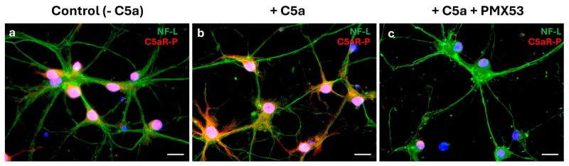 Interaction between C5a and neuron C5aR.