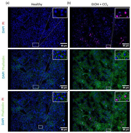 Fluorescence-labeled phalloidin co-stained with PI.