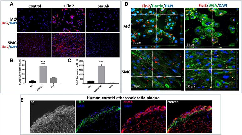 Ficolin-2 interacts with MØ and SMC.