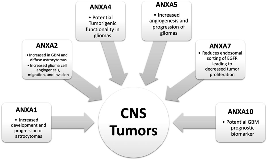 Overview of roles of individual annexins in central nervous system (CNS) tumors.