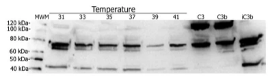 Workflow of hemolytic assay for functional analysis of the CP. (Creative Biolabs Original)