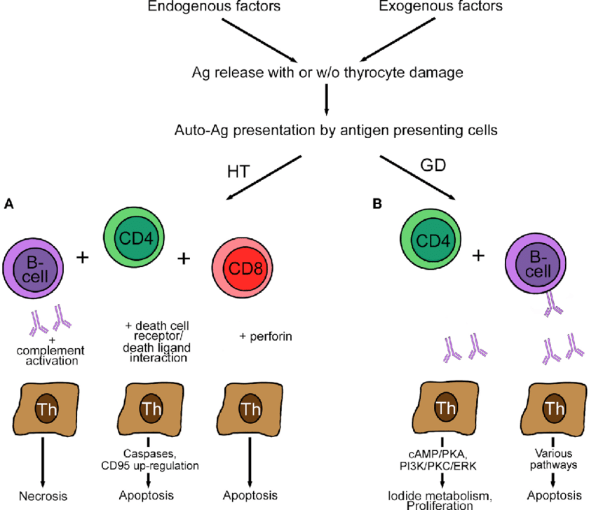 Pathogenesis of Hashimoto's disease.