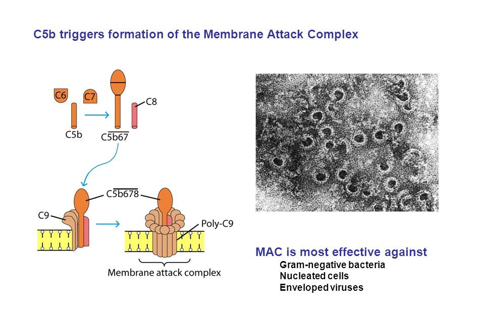The formation and electron micrographs of MAC.