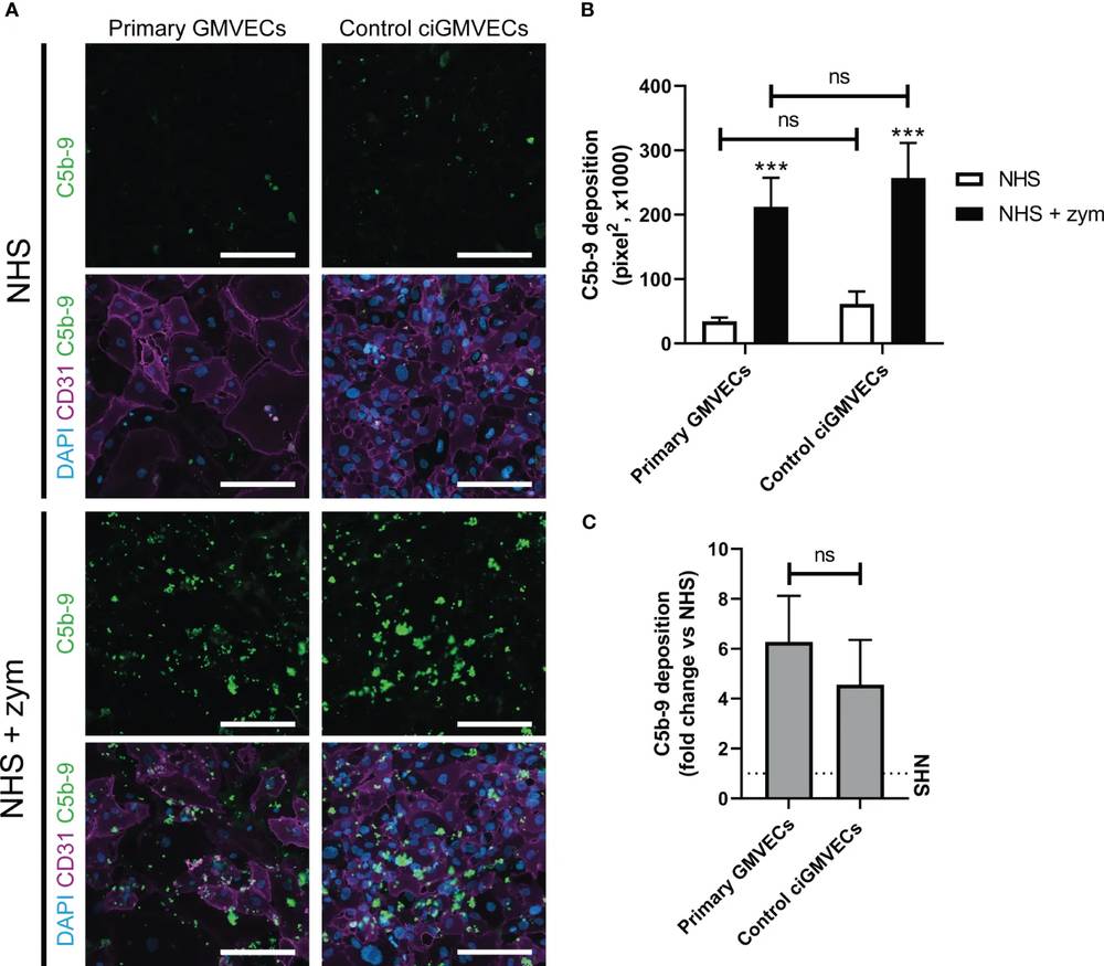 Comparing complement C5b-9 deposition on glomerular endothelial cells. (OA Literature)