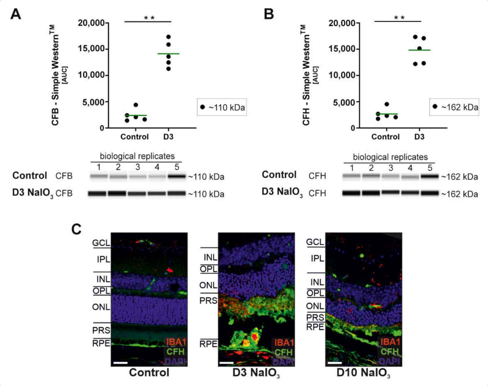 Factor H immunohistochemical staining results show the deposition of factor H in AMD models.