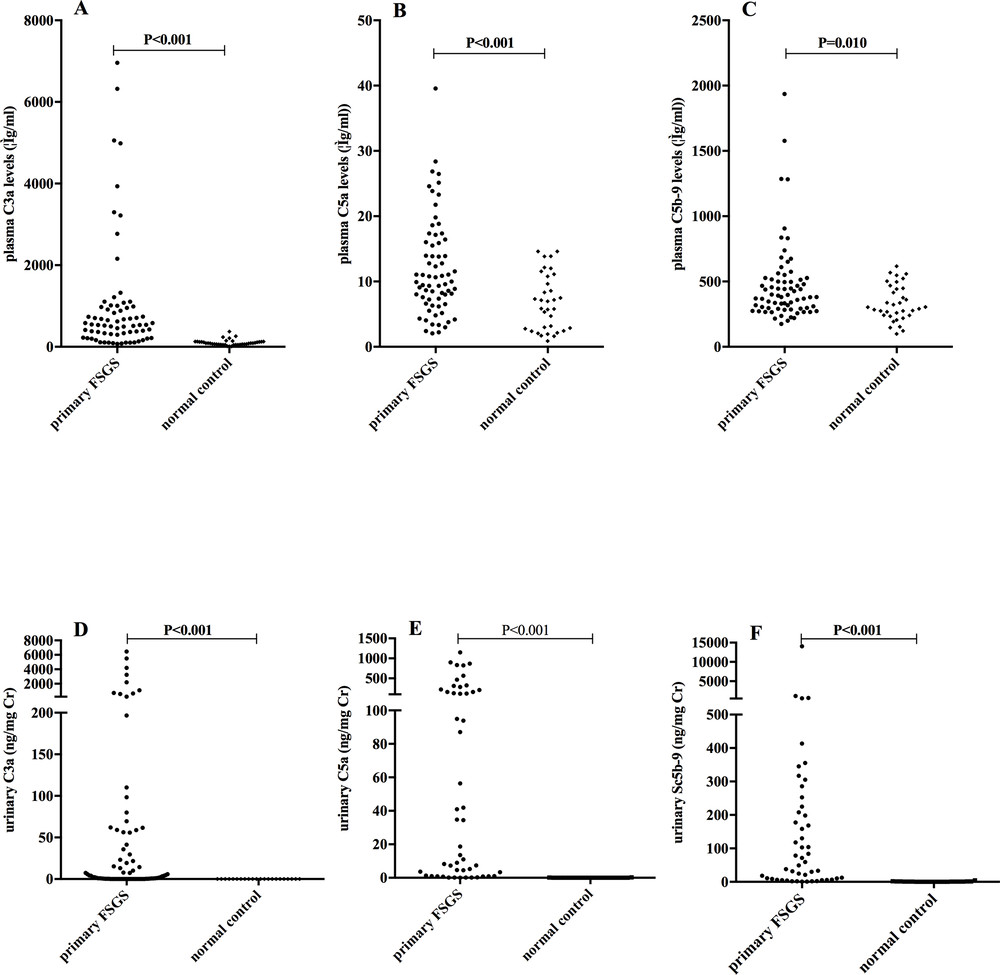 Plasma and urinary C3a, C5a, and soluble C5b-9 levels in primary focal segmental glomerulosclerosis