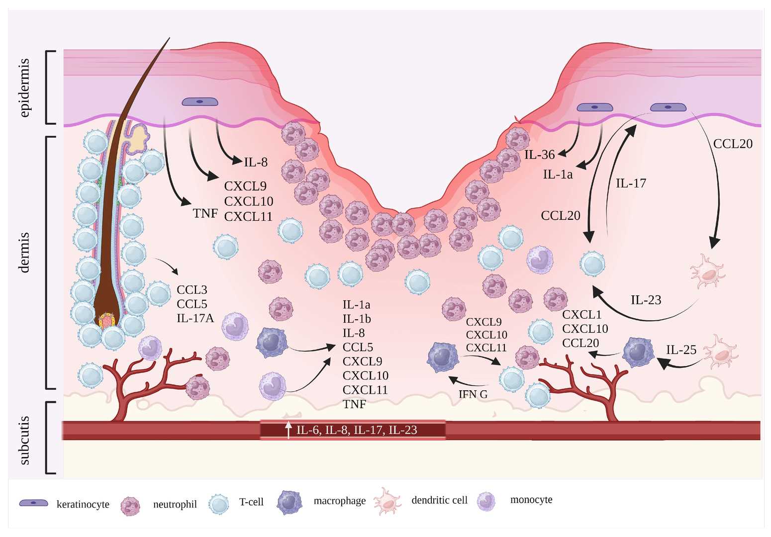 Schematic of the proposed schema of PG pathogenesis in the current understanding. (OA Literature)