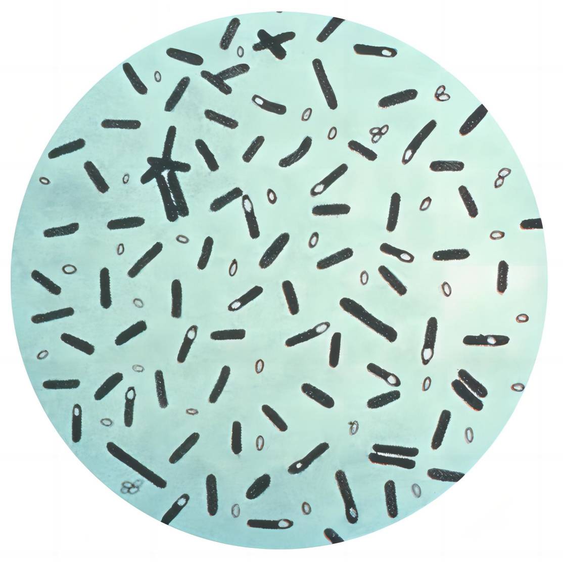 Fig. 1 The picture of Clostridium botulinum. （By Content Providers: CDC - This media comes from the Centers for Disease Control and Prevention's Public Health Image Library (PHIL), with identification number #2107. https://commons.wikimedia.org/wiki/File:Clostridium_botulinum_01.png)