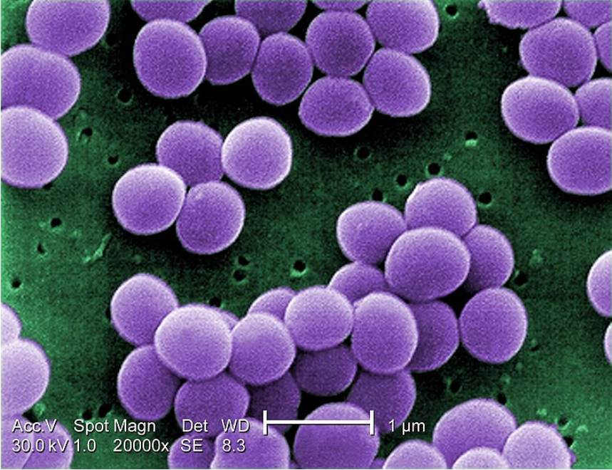 Fig.1 S. aureus. observed in scanning electron micrograph. (Creative Biolabs Authorized)