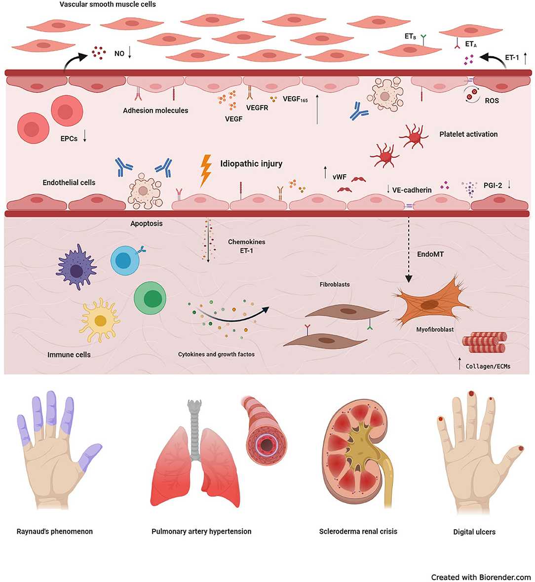 Fig. 1 Fundamental mechanisms underlying vasculopathy in systemic sclerosis. （Zanin-Silva et al., 2021)