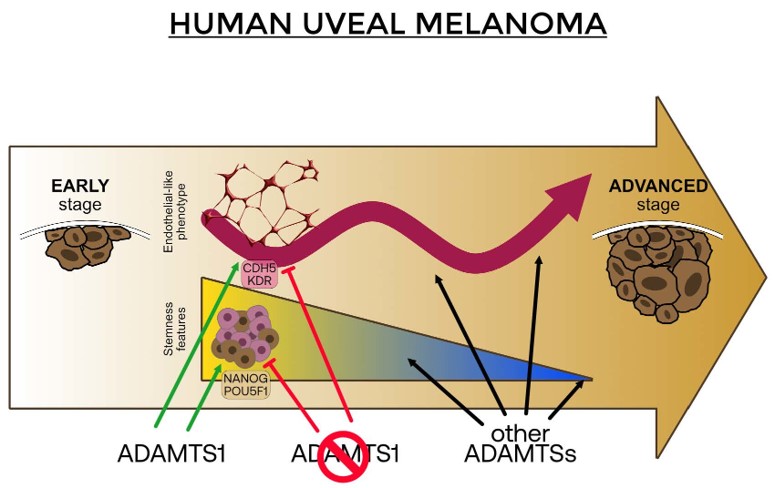 Extracellular protease ADAMTS1 is required at early stages of human uveal melanoma development by inducing stemness and endothelial-like features on tumor cells. (OA Literature)