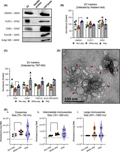 Characterization of EVs derived from human IVD cells. (OA Literature)