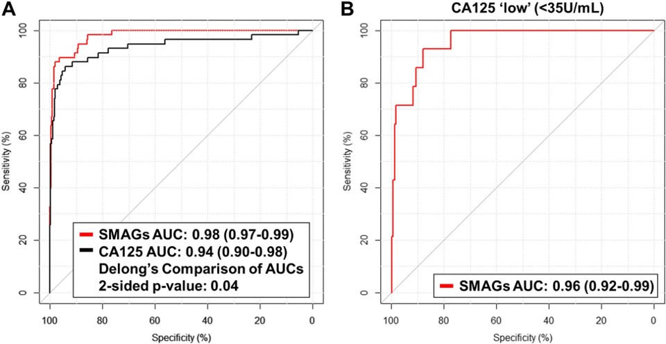 Performance estimates of the SMAGS model consisting of 7 metabolites plus CA125 for detection of early-stage ovarian cancer.