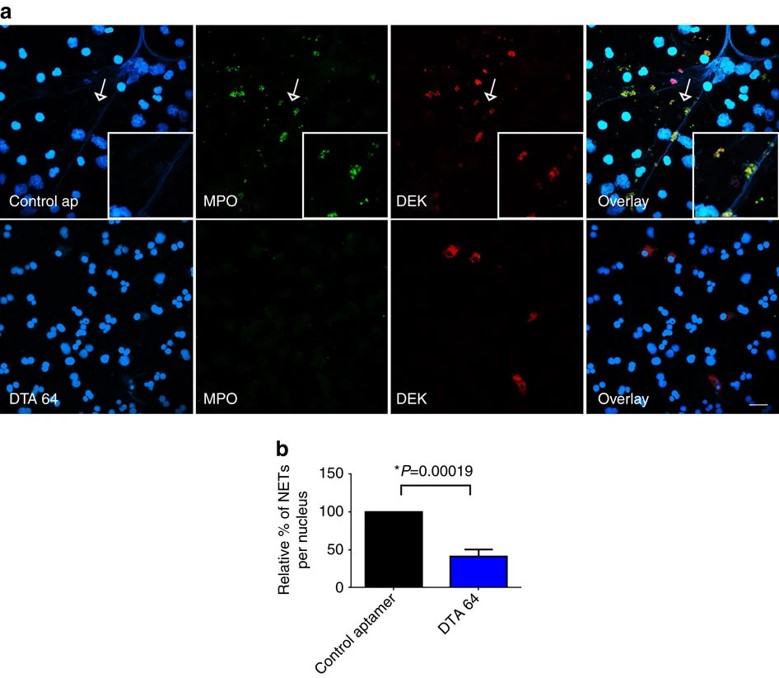 A decrease in NET formation and an increase in the retention of intracellular DEK with the anti-DEK aptamer.