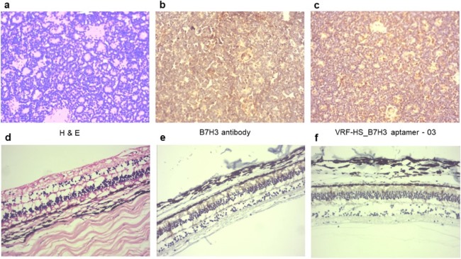 Immunohistochemical analysis was performed using both B7H3 antibody and biotin-labeled B7H3 aptamer on RB tumor sections and retinal tissue.