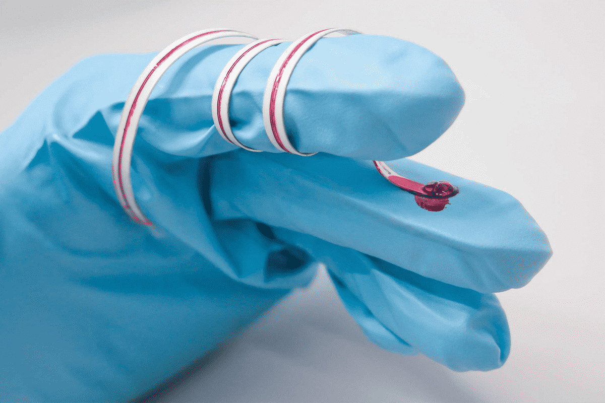 Fig.1 Microfluid sensor. （From Wikipedia: By InnoME GmbH - Own work, https://commons.wikimedia.org/wiki/File:Mikrofluidik_sensor.jpg.)