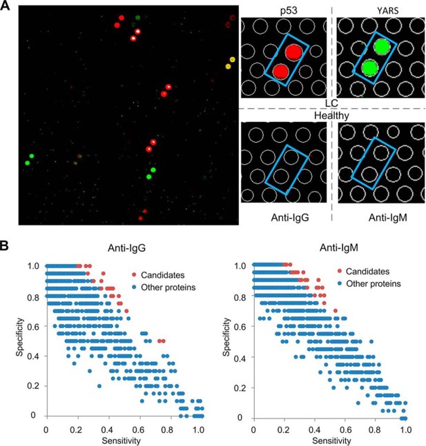 Identification of candidate serological biomarkers in LC using protein arrays.