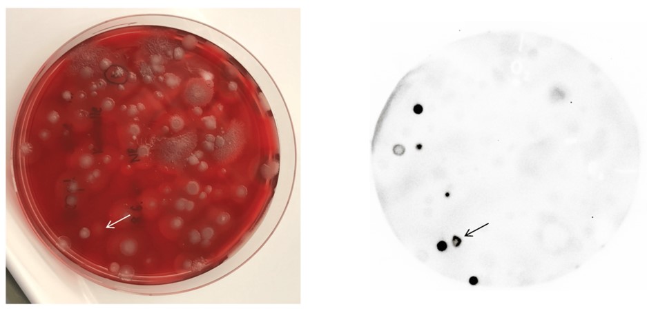 Fig.3 Luminogenic reporter probe NanoLuc-RBP conjugation for identification of B. anthracis in a heterogeneous environmental plate culture.