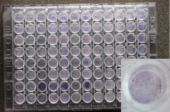 Fig.3 The expression of cytokine was quantified by counting the number of PBMCs secreting the cytokine of interest.
