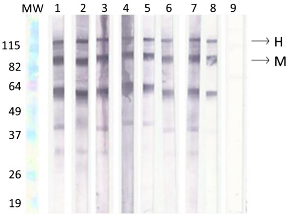 Fig.3 Assessment of membrane viability.
