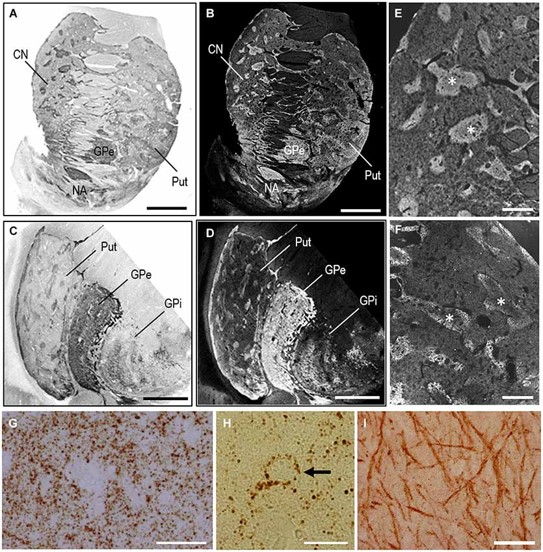Fig.3 MEnk localization in the basal ganglia as determined by PBTA-DAB staining.