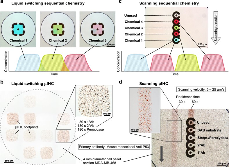 Fig.4 Experimental results of two implementations of sequential chemistry to perform the complete IHC protocol on cell blocks.
