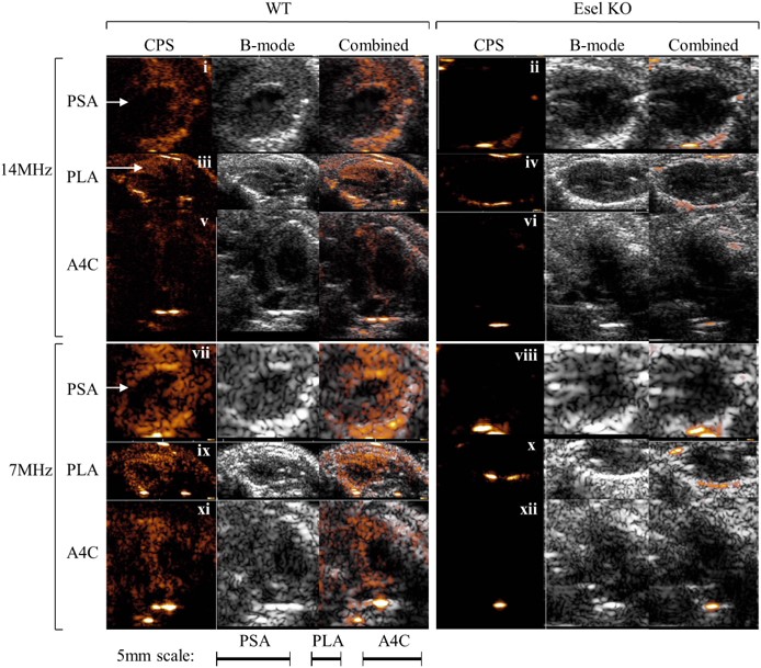 Effectiveness of microbubble for real-time ultrasound imaging of E-selectin expression in the inflamed mouse heart, using a clinical ultrasound scanner.