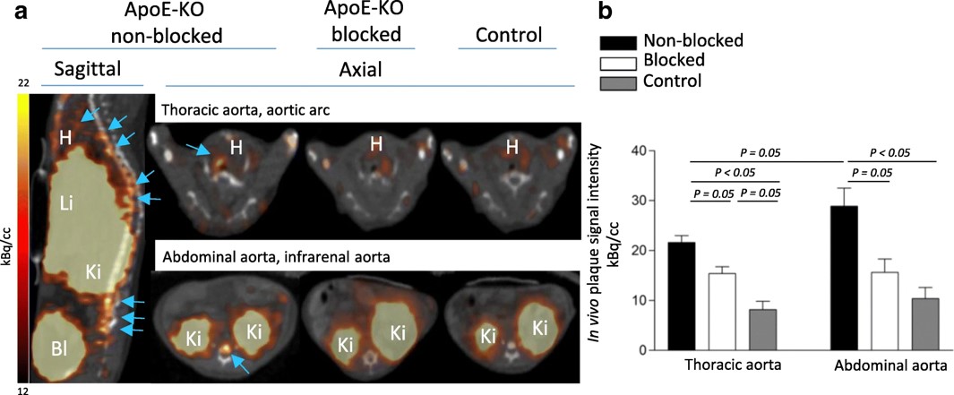 In vivo imaging and tracer uptake quantification in the atherosclerotic plaques using 68Ga-NOTA-anti-MMR Nb.