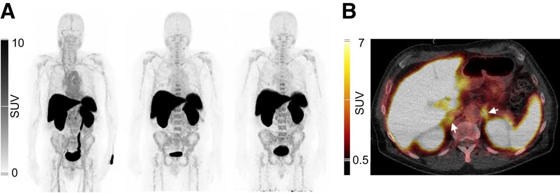 PET/CT images representative of [68Ga]Ga-NOTA-anti-CD206-sdAb biodistribution.