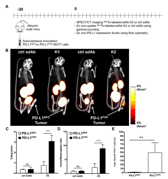 Radiolabeled sdAb allows visualization of human PD-L1POS breast tumors by nuclear imaging.