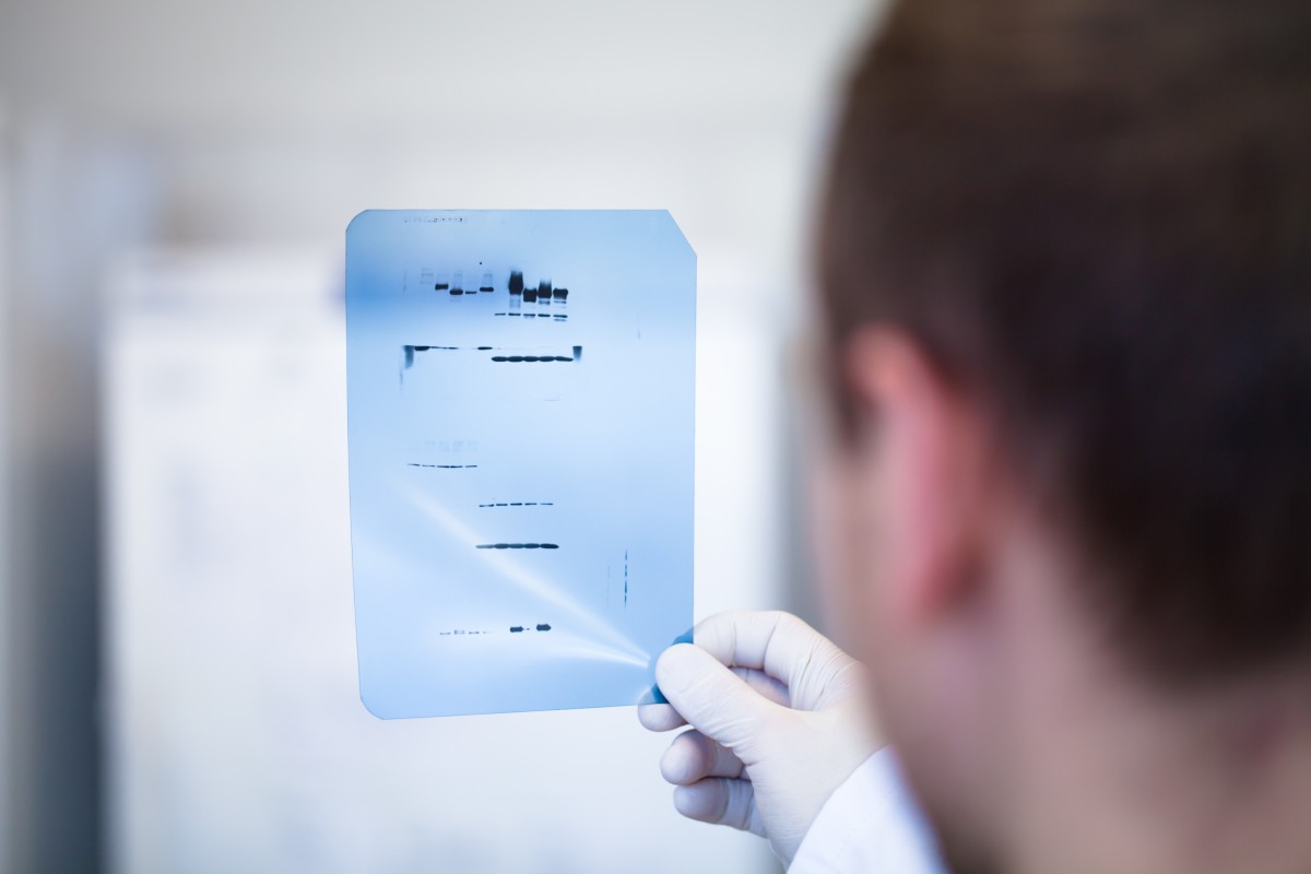 Fig.3 Western-blot. (Creative Biolabs Authorized)