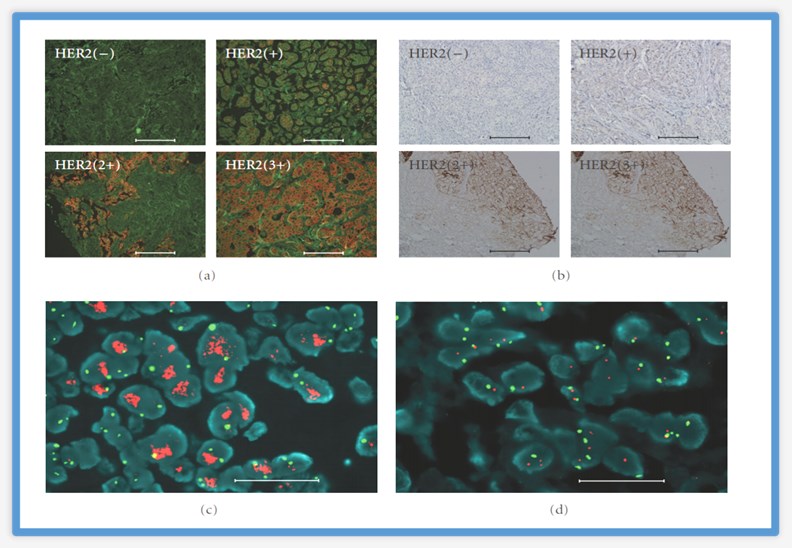 Accurate HER2 testing by QDs-IHC.