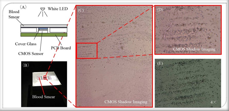 CMOS shadow imaging system.